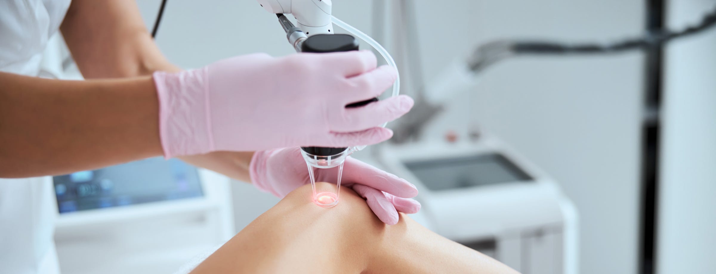 Épilation jambe femme