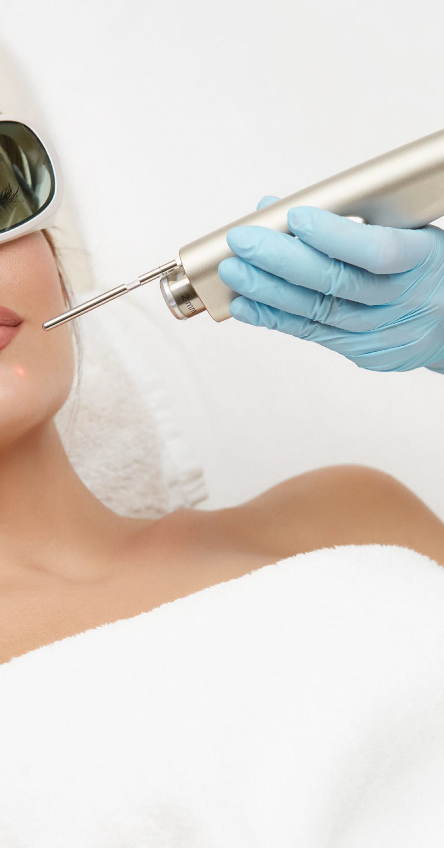 Épilation laser du visage